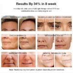 NEWKEY Red Light Therapy Mask for Face Wrinkles, 7 Light Modes with 150LEDS 633nm Red LED Light Therapy Facial Skin Care Mask, At-Home Photon Skin Care Beauty Mask for Anti-Ageing - Image 5
