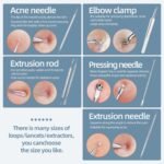 Blackhead Remover Comedone Extractor Acne Removal Kit.. - Image 4