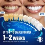 Teeth Whitening Pen Kit - 35% Carbamide Peroxide, Stain Removal, 4 Whitening Pens + 2 Remineralizing Pens, Enamel Repair, Anti-Cavity, Sensitive Teeth Care, 6 x 0.14 fl oz(Mint) - Image 3