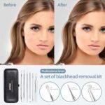 Blackhead Remover Comedone Extractor Acne Removal Kit.. - Image 3