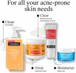 Neutrogena Rapid Clear Stubborn Acne Spot Treatment Gel, Maximum Strength 10% Benzoyl Peroxide Treatment Medication for Acne Prone Skin, Pimple Cream Reduces Size & Redness, 1 oz - Image 9