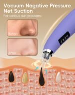 Pore Vacuum Blackhead Remover - Pore Extractor with 5 Attachments & 3 Suction Levels - Blackhead Remover Tools for Women and Men (Purple) - Image 3