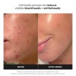 Paula's Choice SKIN PERFECTING 2% BHA Liquid Exfoliant y los Product Highlights: Gentle Salicylic Acid Facial Exfoliator for Blackheads, Enlarged Pores, Wrinkles & Fine Lines | Gentle Salicylic Acid Facial Exfoliator for Blackheads, Enlarged Pores, Wrinkles & Fine Lines - Image 4