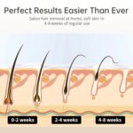 Ice Cooling IPL Home Use Hair Removal Device, Laser Hair Removal Machine Painless Epilator for Women Men, 3 Energy Levels & 2 Modes, Face Body Use with Razor & Glasses - Image 7