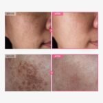TOSOWOONG Arbutin 7% + Tranexamic Acid 4% Cream, 70,000ppm Arbutin, 40,000ppm TXA, Niacinamide, Glutathione, Dark Spots, Freckle, Blemishes, Pigmentation, Korean Skin Care, 50ml, 1.69 fl.oz. - Image 3