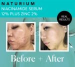 Naturium Niacinamide Face Serum 12% Plus Zinc 2%, Anti-Aging, Pore Minimizer & Dark Spot Corrector with Hyaluronic Acid & Vitamin E, Vegan & Cruelty-Free, 1 oz - Image 6