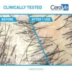 CeraVe Hydrating Anti Dandruff Shampoo, Itchy Scalp Treatment, 12oz | Helps Eliminate Flakes with 1% Pyrithione Zinc, Hyaluronic Acid, Niacinamide and Ceramides In A Sulfate Free Formula - Image 4