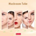 Quiet&Far High Frequency Facial Machine Skin Care Tool for Wrinkles Reducing Skin Tightening High Frequency Facial Wand with 4 Tubes - Image 5