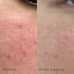 DIME Beauty Super Skin Toner - Witch Hazel Face Toner, 4 oz | Alcohol-free with CoQ10, Hyaluronic Acid & Cucumber Extract. Pore-tightening, brightening antioxidant toner. - Image 5