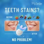 MySmile Teeth Whitening Kit with LED Light, 10 Min Non-Sensitive Fast Teeth Whitener with 3 Carbamide Peroxide Whitening Gel, Helps to Remove Stains from Coffee, Smoking, Wines, Soda, Food - Image 4