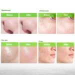 Blooskim Blackhead Remover Mask for Face: Black Peel Off Face Mask – Charcoal Peel Off Face Mask for Oily & Combination Skin – Refreshing Botanical Formula, 2.8 fl oz - Image 5
