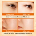 Vitamin C Niacinamide Skincare Set, Daily Facial Care Routine with 6-Piece | Includes Cleanser, Toner, Serum, Moisturizer, Eye Cream & Lotion, Gentle Formula, All Skin Types - Image 8