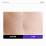 FRANKLY Closer Serum | Pore Minimizer Serum | 1.01 fl oz | 9 Peptides, Vegan Collagen, Adenosine, PHA | Korean Pore Minimizer for Glass Skin, Anti-Aging, Hydration, Elasticity - Image 3