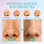 VOYOR Blackhead Remover Pore Vacuum with 6 Suction Heads for Face | 3 Suction Modes, Rechargeable Blackhead Remover Tool with Microcrystalline Head, Pore Cleaner Acne White Heads Removal, BR410 - Image 4