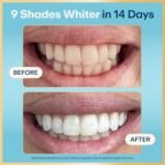 Lumineux Teeth Whitening Strips, Peroxide Free, 21 Treatments (3 Months) | Peroxide free, enamel safe, dentist formulated, clinically tested & proven, free from harsh ingredients, no sensitivity - Image 3
