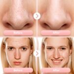 Blackhead Remover Vacuum, Facial Pore Extractor, 5 Suction Levels, 5 Probes | USB Rechargeable Pore Cleaner, Electric Comedone Whitehead Extractor Tools, 4 Stainless Steel Tools - Image 6