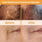 Pure Daily Care NuDerma Handheld Skin Therapy Wand Machine w/Neon – Anti-Aging - Skin Tightening - Wrinkle Reducing - Dark Circles – Clarifying - Hair & Scalp Stimulator - Image 8