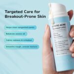 BellamiLuxx Cystic Acne Treatment for Face: Hormonal Acne Treatment Cream for Teens & Adults - Salicylic Acid & Tea Tree Oil Pimple Spot Remover - Anti-Acne Moisturizer Reduces Redness, Blemishes - Image 5