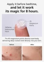 EasyDerm Quick Microdart Magnesium Pimple Patch 20ea - Cica Ampoule&Tweezer | Acne Spot Treatment, Zit Sticker, Daewoong Pharmaceutical, Overnight Home Care 8 hour, Summer Season Travel Essentials - Image 5