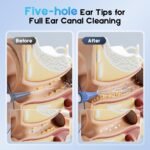 Electric Ear Wax Removal Kit for Adults with 4 Cleaning Modes, Home Use | Safe and Effective Ear Irrigation Flushing System with 500ml Water Bottle, Towel, Waste Basin, 15 Tips, Blue - Image 5