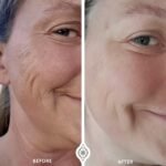 The OMG Blaster 5-in-1 Face Lifting Tool by Ashley Black. Patented Technology for Fine Lines, Wrinkles, Skin Tightening, Face Contouring, Lymphatic Darinage and Temporary Blood Flow - Image 6