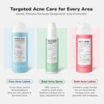 BellamiLuxx Cystic Acne Treatment for Face: Hormonal Acne Treatment Cream for Teens & Adults - Salicylic Acid & Tea Tree Oil Pimple Spot Remover - Anti-Acne Moisturizer Reduces Redness, Blemishes - Image 8