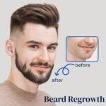 5% Minoxidil for Men Beard and Hair, Minoxidil for Women Hair Growth Spray with Biotin & Castor Oil, Strengthens Weak Roots, Repairs Thinning Hair Spray (60ml, 2PCS-Spray) - Image 4