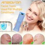 Blue Light Therapy Device for Acne Spot Treatment | LED Acne Blue Light Therapy Wand for Face - Image 3