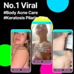 SOME BY MI AHA BHA PHA 30 Days Miracle Acne Clear Body Cleanser 13.5oz – Salicylic Acid & Tea Tree Acne Body Wash – Deep Cleansing, Sulfate & Paraben Free Korean Skin care - Image 3