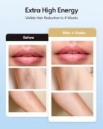 INNZA IPL Hair Removal with Ice Cooling Care Function for Women | Long-Lasting Results,999,999 Flashes Painless Hair Removal, for Armpits Legs Arms Bikini Line,Corded,Pink - Image 4