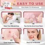 432 Counts Pimple Patches for Face, Hydrocolloid Acne Patches Zit Patches for Face Acne Spot Treatment Patch Cystic Acne Treatment Stickers Blemish Hydrocolloid Patches for all Skin Type - Image 7