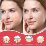432 Counts Pimple Patches for Face, Hydrocolloid Acne Patches Zit Patches for Face Acne Spot Treatment Patch Cystic Acne Treatment Stickers Blemish Hydrocolloid Patches for all Skin Type - Image 3