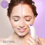 Essy Blackhead Remover Facial Cleanser Machine for Pimple Suction (Purple) | Pore Deep Suction, 5 level adjustable intensity, rechargeable, 4 suction probes, Suits All Skin Types - Image 4