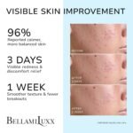 BellamiLuxx Cystic Acne Treatment for Face: Hormonal Acne Treatment Cream for Teens & Adults - Salicylic Acid & Tea Tree Oil Pimple Spot Remover - Anti-Acne Moisturizer Reduces Redness, Blemishes - Image 3