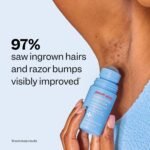 Peach Slices - Smoothing Solution Ingrown Hair Treatment (1.69 oz) - Smooth, Relieve, Soften Skin - 360 Roller - BHA, AHA, PHA, Niacinamide, Licorice - Vegan & Cruelty Free - Korean Skin Care & Beauty - Image 6