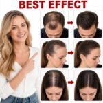 Red Light Therapy Hat, Laser Hair Growth Cap for Men & Women, Black | 650nm LLLT Hair Loss Solution, Full Scalp Coverage Treatment, Daily Use, Cordless & Rechargeable - Image 4