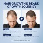 Minoxidil for Men Liquid Solution, Minoxidil for Women Hair Growth Serum, 5% Minoxidil Serum for Stronger Roots & Thicker, Fuller Hair (4 FL OZ, 2PCS-Dropper) - Image 6