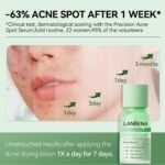 LANBENA 2% Salicylic Acid Acne Spot Treatment Drying Lotion, 0.42 Fl Oz | Fast-Acting Dry Out Pimples, Fade Acne Marks & Redness Relief, Overnight & Period Breakouts, Acne-Prone Sensitive Skin - Image 7