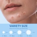 Daolyo Pimple Patches for Face, 4 Size 300 Counts Acne Patches, Hydrocolloid Patches for Covering Zits and Blemishes, Spot Stickers with Salicylic Acid, Tea Tree Oil & Calendula Oil - Image 4