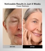 INIA Red Light Therapy Mask for Face, 850nm NIR, Red/Blue LED Light 4 Modes | Visible Results in Just 4 Weeks, 220 LEDs, 105mW/cm² Output, 2600mAh Rechargeable Battery, 10-30min Timer, Auto Shut-off - Image 7
