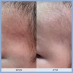 mongdies Baby Soothing Gel | Cooling & Calming Water Gel for Sensitive Skin | Non Sticky Lightweight Moisturizer | Hyaluronic Acid & Panthenol | Vegan EWG Green | 6.76 fl oz - Image 8