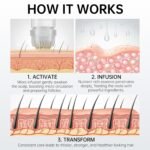 Micro Infusion Hair Regrowth System – Hair Growth Treatment with Ginseng, He Shou Wu, Angelica & Hyaluronic Acid, Thickening Serum for Fuller, Stronger Hair – Premium Scalp & Hair Care for Men & Women - Image 5