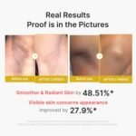 medicube Body Peel Shot with Kojic Acid and Turmeric | Gentle Body Brightening & Exfoliating with BHA LHA PHA - Dead Skin Cells, Uneven Looking Skin & Excess Sebum, 9.46 fl.oz - Image 6