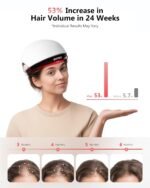 Red Light Therapy for Hair Growth with 162 Lasers | Laser Hair Growth Cap for Hair Loss, Rechargeable Battery- FDA Cleared Hair Growth for Men & Women - Image 4