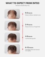 Red Light Therapy for Hair Growth with 162 Lasers | Laser Hair Growth Cap for Hair Loss, Rechargeable Battery- FDA Cleared Hair Growth for Men & Women - Image 5
