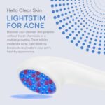LightStim for Acne LED Red Light Therapy, FDA cleared for mild to moderate acne, reduce acne, calm existing breakouts & restore your skin’s healthy appearance 36 Blue & Red LEDs, 415 & 630 wavelengths - Image 6