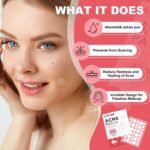 432 Counts Pimple Patches for Face, Hydrocolloid Acne Patches Zit Patches for Face Acne Spot Treatment Patch Cystic Acne Treatment Stickers Blemish Hydrocolloid Patches for all Skin Type - Image 4