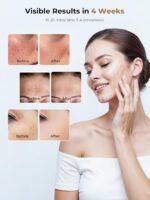 LED Light Therapy Mask (E106A) for Face, 850NM Near-Infrared Portable Rechargeable Red Light Therapy Mask, Soft Silicone Red Light Therapy with Timer for Home & Travel - Image 4