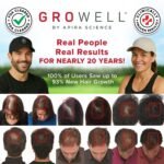 GroWell Red Light Therapy Hair Growth Cap – FDA Cleared Laser Treatment for Hair Regrowth and Reduced Shedding – LED & Laser Red Light Therapy Clinically Proven in Double-Blind Studies -Black - Image 3