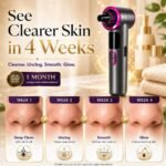 Heated Blackhead Remover Vacuum, Warm Compress Pore Vacuum Cleaner with 3 Suction Levels, LED Display, USB Rechargeable Facial Pore Cleaner Kit, 5 Heads and 4 Stainless Steel Tools (Purple) - Image 7